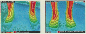 Thermo Image 2